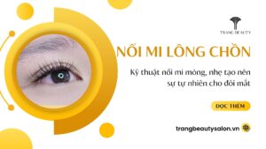 noi mi long chon
